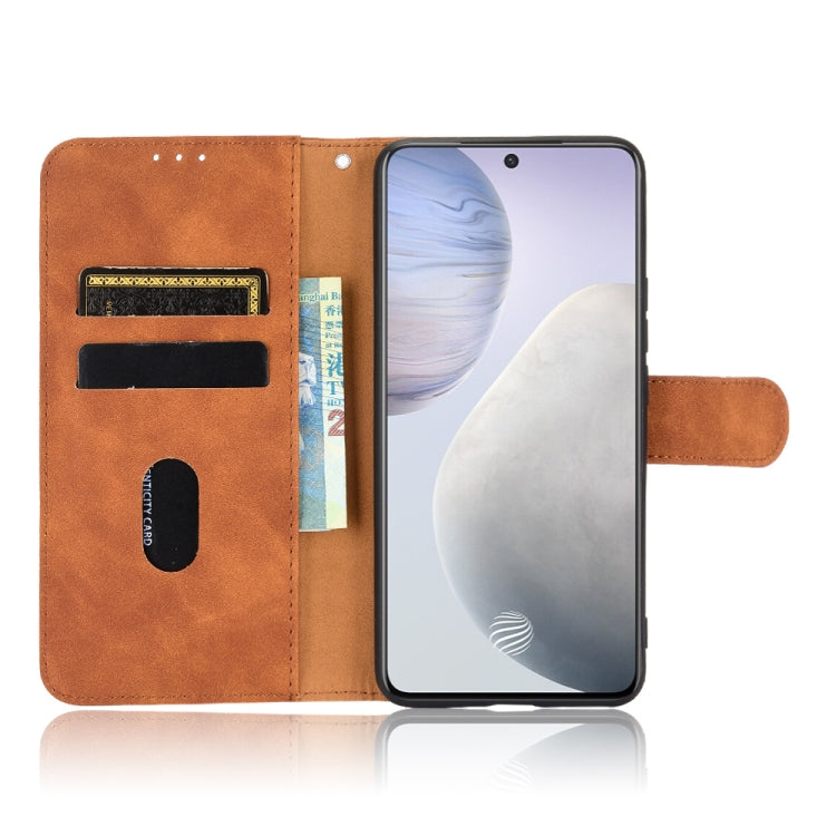 Solid Color Skin Feel Magnetic Buckle Horizontal Flip Calf Texture PU Leather Case with Holder & Card Slots & Wallet