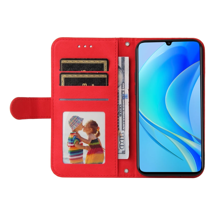 Skin Feel Life Tree Metal Button Leather Phone Case