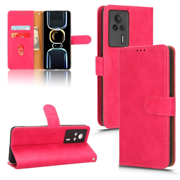 Skin Feel Magnetic Flip Leather Phone Case, For vivo Y02 4G, For Honor 80 GT, For Motorola Moto X40, For Xiaomi Redmi K60E 5G, For ZTE nubia Red Magic 8 Pro 5G