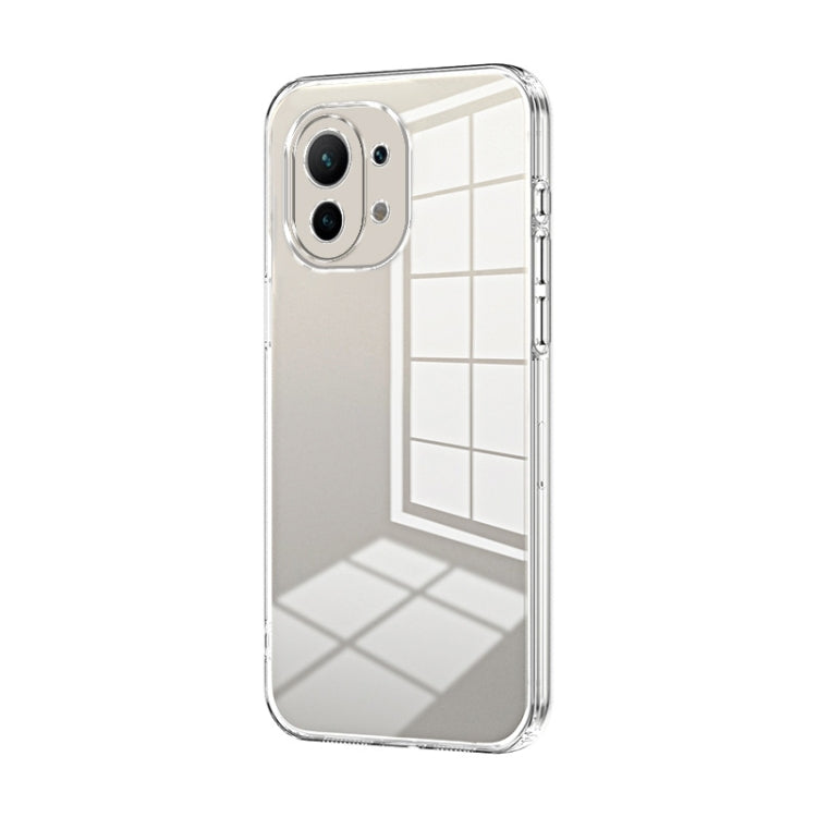 Transparent Plating Fine Hole Phone Case